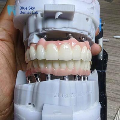 China Layered Zirconia Implant Customization Full Arch Implant Cases for sale