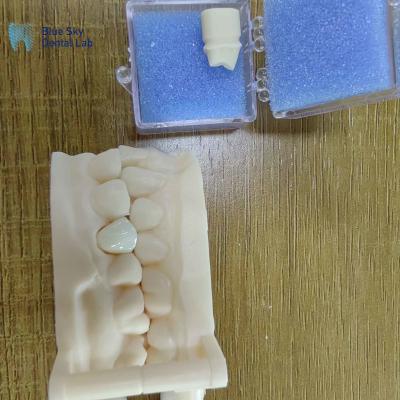 China Estética Restauración dental de zirconia Coronas de porcelana de zirconia en venta