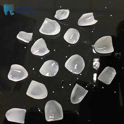 China Ultrathin E Max Veneers Ingot Class Ceramic Natural Looking Veneers for sale