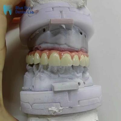 China Nature Artificial Dental Implant Cases Customized Full Mouth Implant Case for sale