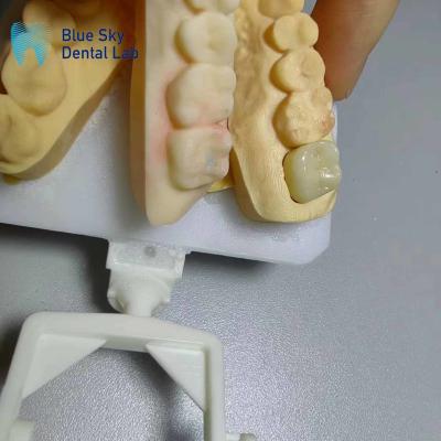 China Corrosion Resistant Zirconia Crowns Natural Looking Zirconia Teeth for sale