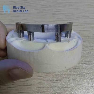 China Barras de titanio dentario de precisión Barras de titanio pulidas para implantes dentales en venta