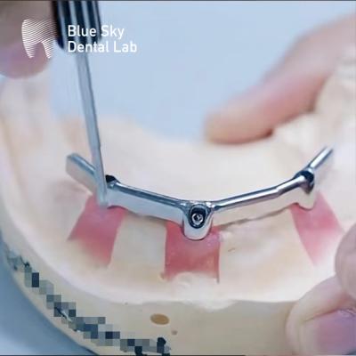 China Barras de titanio de precisión dental con accesorios preciosos biocompatibles en venta