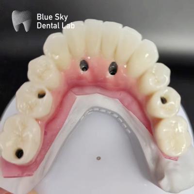 China Casos de implantes dentales de arco completo compatibles con sistemas de implantes múltiples en venta