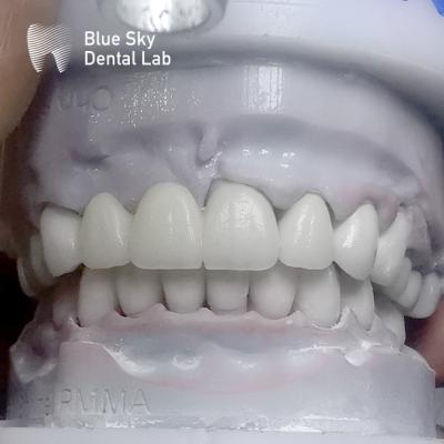 China Dentes de zirconia rectangulares de capas múltiples antes del acristalamiento en venta