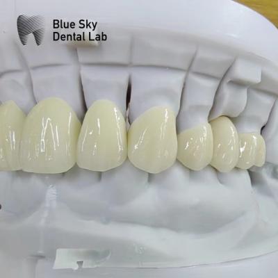 China Translucent Layered Zirconia Crown Dental Restoration Multilayer Zirconia Crown for sale