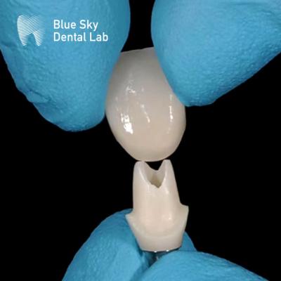 China Oral Scan Custom Zirconia Abutment High Strength Zirconia Abutments for sale