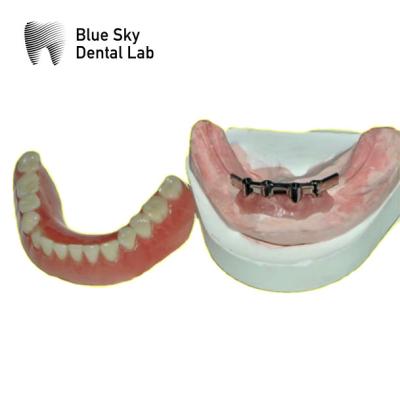 China Barras de titanio dentales extraíbles para dentaduras azul cielo en venta