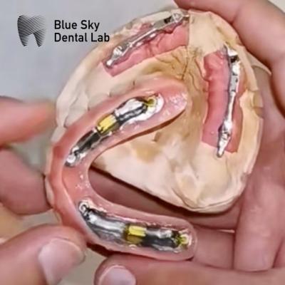 China Implantes dentais Blue Sky com barra de titânio para próteses removíveis à venda