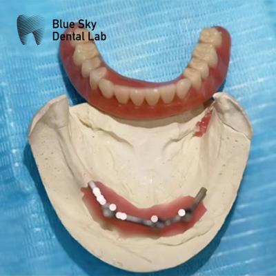 China Implante de titânio de barra azul para implantes dentários à venda