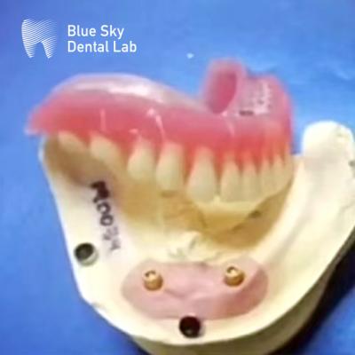 China Localizador dental de titanio con dentadura extraíble y conexiones con tapa de bola en venta