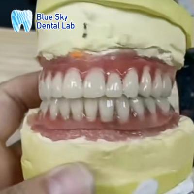 China Implantes Dentários de Titânio de Barra Superior e Inferior à venda