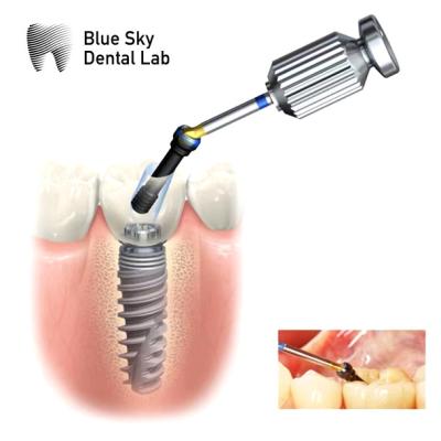 Cina Abutment ASC esessoriale interno Abutment del canale a vite angolato regolabile in vendita