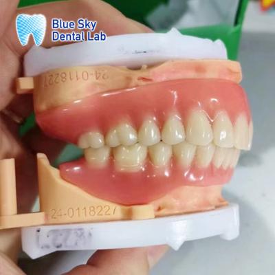 Cina Dentiera acrilica rimovibile a arco pieno Dentiera personalizzabile dall'aspetto naturale in vendita