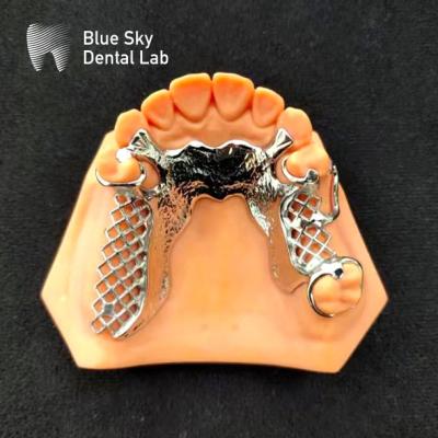 China Esqueleto Cromo Dentadura Parcial de Metal Impreso Diseño de Dentadura CoCr en venta