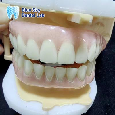 China Bluesky Temporary Acrylic Partial Denture Full Upper And Lower Acrylic Denture for sale