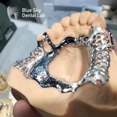 China Blue Sky Dental Framework Partial Maxillary Denture Cast Metal Framework for sale