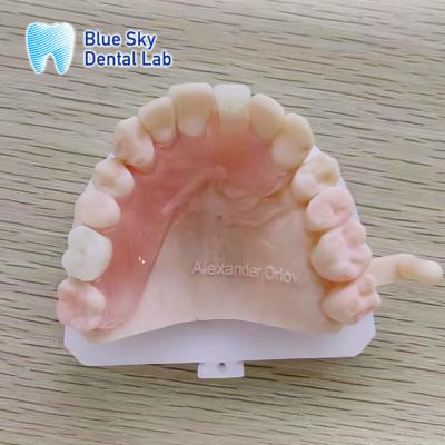 China Natural Looking Removable Valplast Partial Dentures For Upper Anterior And Posterior Teeth for sale