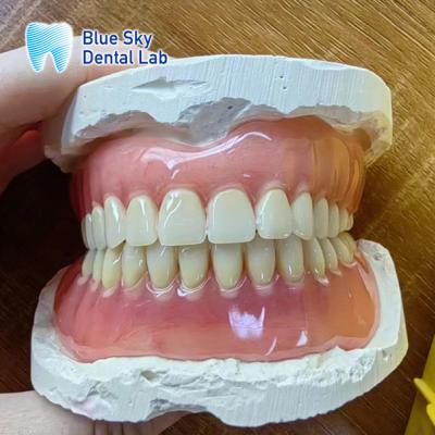 China Dentes faltantes Restauración de prótesis dental completa acrílica en venta