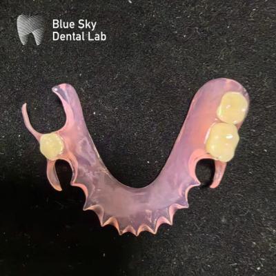 China Customize Removable Acrylic Partial Denture Natural Looking Valplast Dental Partials for sale