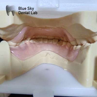 China Resin Valplast Flexible Partial Dentures Before And After Valplast Partial Denture for sale