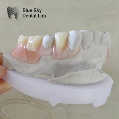 Chine Sourire naturel Prothèses dentaires à plaquette de dentition à plaquette de dentition partielle amovible à vendre