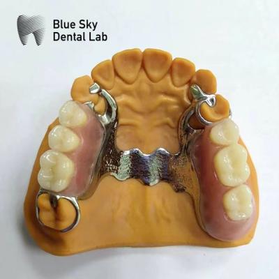 China Dental molde de dentadura parcial marco de dentadura parcial que parecen reales en venta