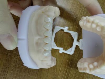 China E.Max carcasas de chapa pasiva en varios colores hacer una sonrisa hermosa con un mínimo de preparación dental en venta