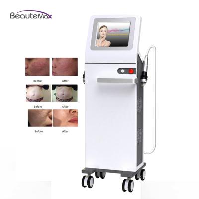 China 2021 fractional skin rejuvenation rf microneedling/microneedle laser therapy system/fractional rf microneedle face treatment mahicne price for sale