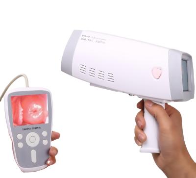 China Hospital Acrylic Medical Equipment Factory Price Electric Digital Hd Vaginal Camera For Gynecology Video Colposcopy System for sale