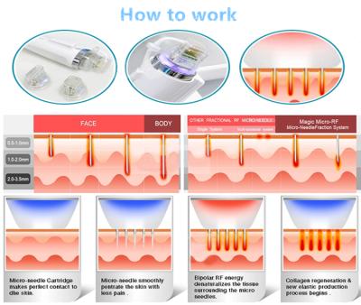 China Popular Type 4 Needles Microneedling Skin Rejuvenation RF Microneedle Partial Wrinkle Remover Machine for sale