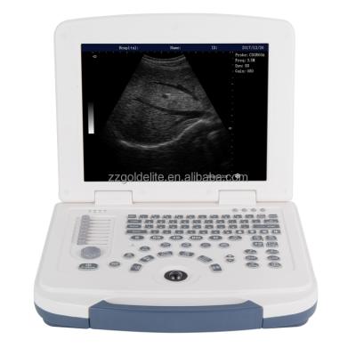 China Visit Service Portable Black And White Ultrasound Scanner Portable Ultrasound Machine for sale