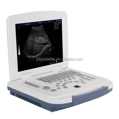 China Tour Service Laptop Ultrasound Scanner Cost Portable Ultrasound Machine Manufactures for sale