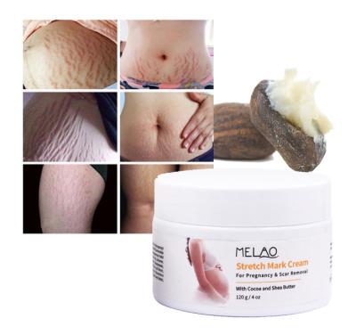 China Moisturizer Melao Stretch Mark Cream Removal Private Label OEM ODM ODM Natural Organic Body Mark Postpartum Anti Stretch Marks Removal Cream for sale