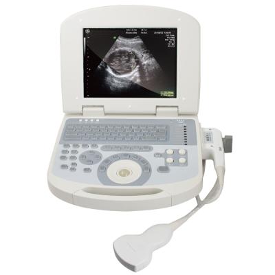 China Best Selling Laptop Obstetrics Gynecoloyg Convex, Linear, Micro-convex, Transvaginal, Rectal Ultrasound and Portable Ultrasound Scanner for sale