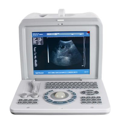 China Digital Acrylic Portable Ultrasound Scanner for sale