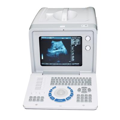 China Metal Hospital Used Medical Equipment Portable Ultrasound Scanner Machine Price for sale