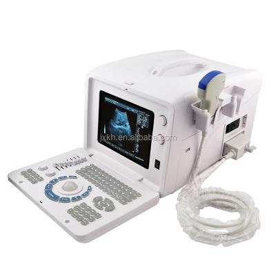 China Medical CE Portable Medical Device Hospital Clinic Ultrasound Diagnose Scanner/Machine With Probe Transducer RUS-6000D for sale