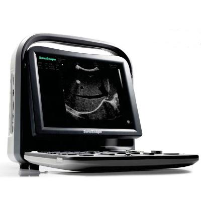 China 12 Inch Large Screen Super Ultrasound Machine Sonoscape A5 Hospital Full Function Portable Black And White System for sale