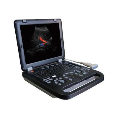 China OB MY-A024E Medical Diagnostic Instrument System Laptop Ultrasound Ultrasound Scanning Machine for sale