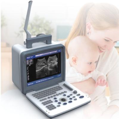 China MY-A003C Portable Metal Ultrasound Scanning Ultrasound Instruments Medical Ultrasonic Imaging Machine Black And White Price for sale