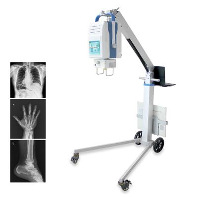 China X-ray room. X-ray service | MY-D049R medical mobile x ray equipment price, digital portable x ray scanner for sale