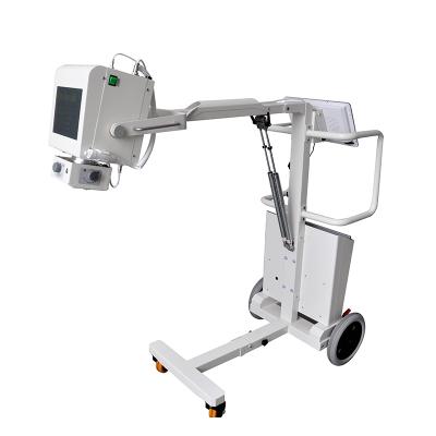 China MY-D019E MY-D019E High Frequency Digital Radiography System Mobile X-ray Machine for sale