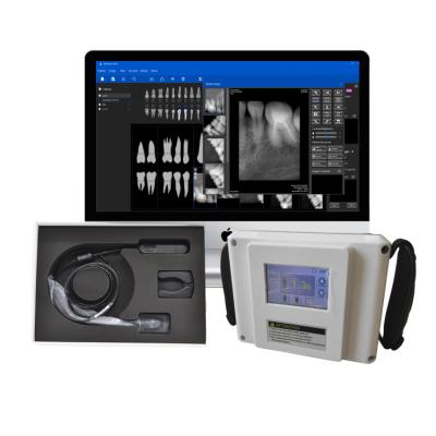 China Metal Rayos X-Ray Dental Equipment Portable Dental Digital X-Ray Machine Can Use With RVG Sensor for sale