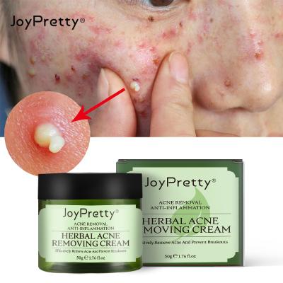 China Anti-inflammatory Acne Acne Cream Herbal Pimple Removal Cream Treatment Moisturizer Acne Removing Cream for sale