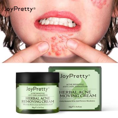 China Skin Revitalizer Hydrate Beauty Pimples Dark Spot Remover Face Acne Green Tea Organic Natural Hydration Cream for sale