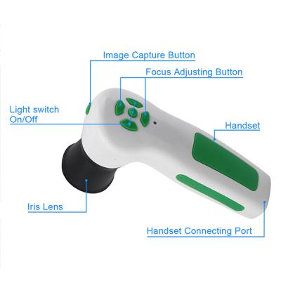 China Body Health 12MP 12 Megapixel Computer Iris Hair Skin Detector Iris Detection Instrument for sale