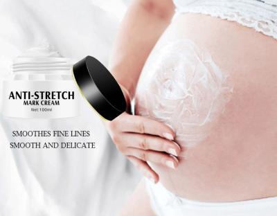 China Best Natural Organic Herbal Herbal Anti Scar Repair Pregnant Stretch Mark Nourishing Mark Removal Cream for sale