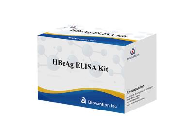 China Human HBeAg Elisa Test Kit Blood Hepatitis B Envelope Antigen Test for sale