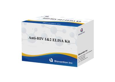 Κίνα Ανθρώπινη αντι εξάρτηση δοκιμής HIV 1&2 Elisa τον ιό για ανθρώπινης ανεπάρκειας αντισωμάτων προς πώληση